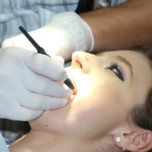 Best Teeth Removal Clinic in Delhi