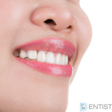Best Teeth Whitening Clinic