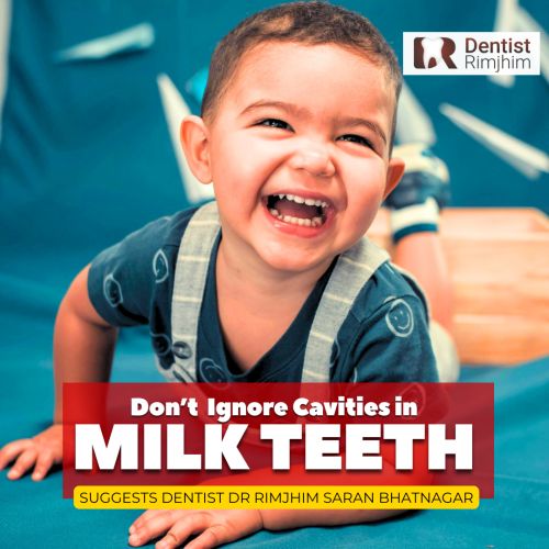 Baby Teeth Matter: Why You Shouldn’t Ignore Cavities in Milk Teeth