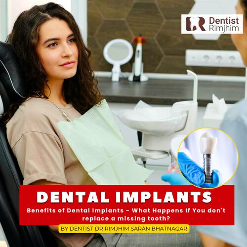 best dentist for implants in munirka delh_dr rimjhim bhatnagar