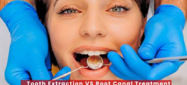 Tooth Extraction VS Root Canal Treatment: Which Option is Best for Your Teeth?