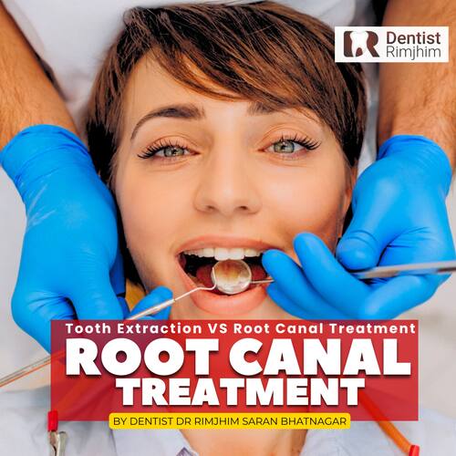Tooth Extraction VS Root Canal Treatment: Which Option is Best for Your Teeth?