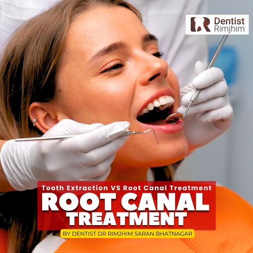 best dentist root canal in delhi_dr rimjhim bhatnagar
