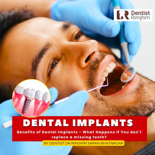 dr rimjhim bhatnagar_best dentist in south delhi for implants