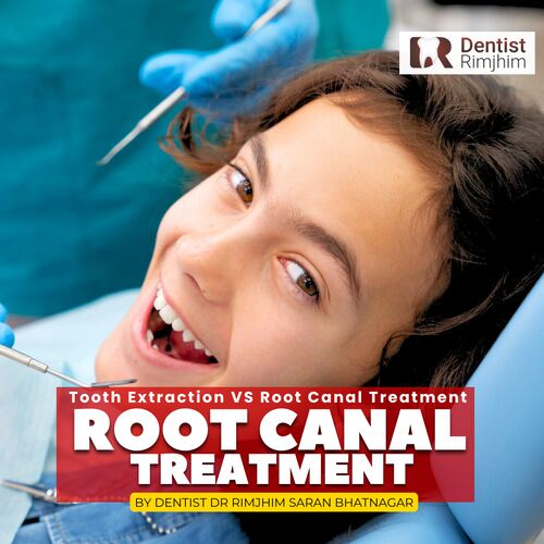 top dental surgeon for root canal treatment in delhi_dr rimjhim bhatnagar