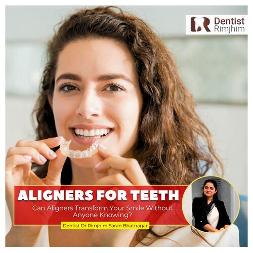 Can Aligners Transform Your Smile Without Anyone Knowing?