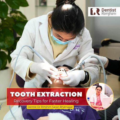 Tooth Extraction Recovery Tips for Faster Healing