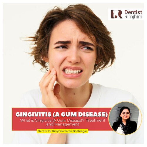 What is Gingivitis (A Gum Disease)? Treatment and Management