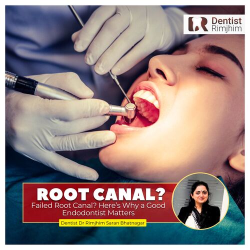 Dr Rimjhim Bhatnagar_best dentist for root canal in delhi