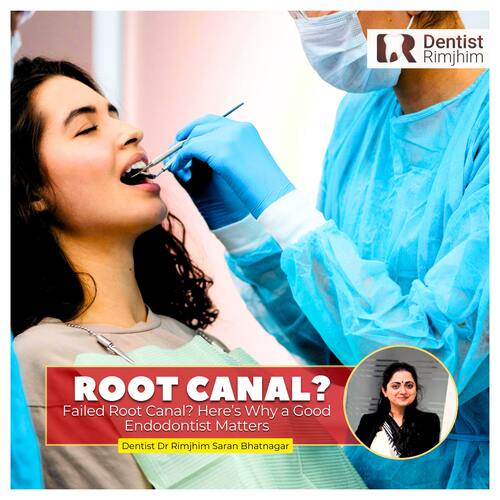 Failed Root Canal? Here’s Why a Good Endodontist Matters
