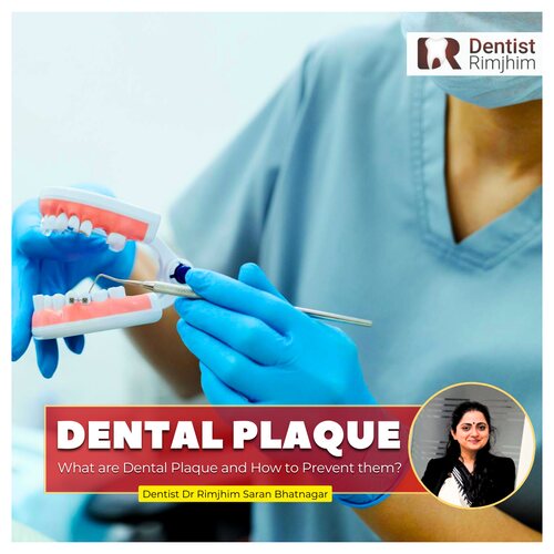 Dr Rimjhim Bhatnagar_best dentist in delhi