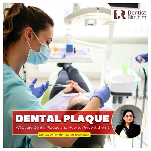 What are Dental Plaque and How to Prevent Them?