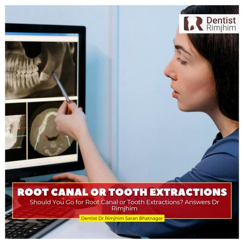 Should You Go for Root Canal or Tooth Extraction? Answers Dr Rimjhim