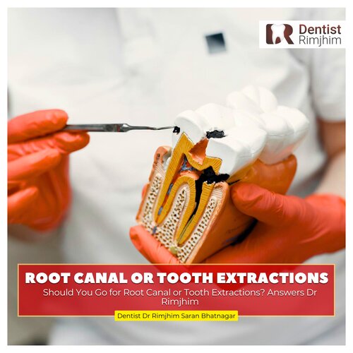 best dentist for painless tooth extraction in delhi ncr_dr rimjhim bhatnagar