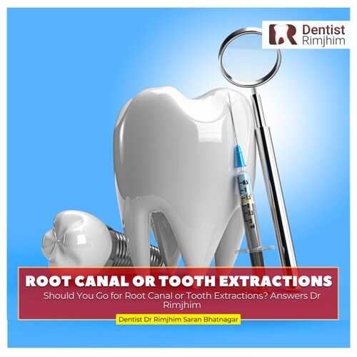 best root canal treatment in delhi_dr rimjhim bhatnagar