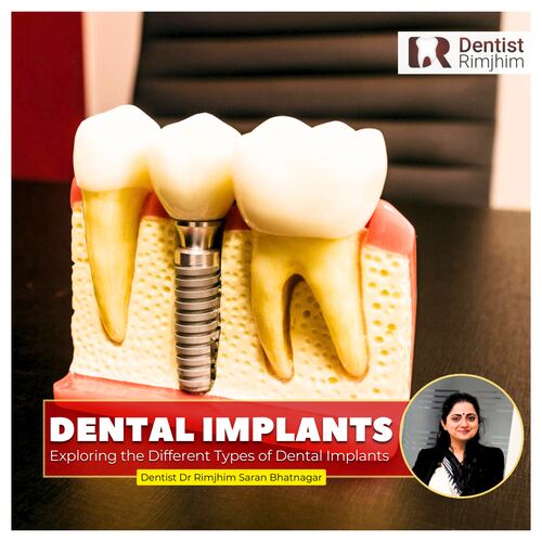 Dr Rimjhim Bhatnagar_best dental surgeon for implants in delhi