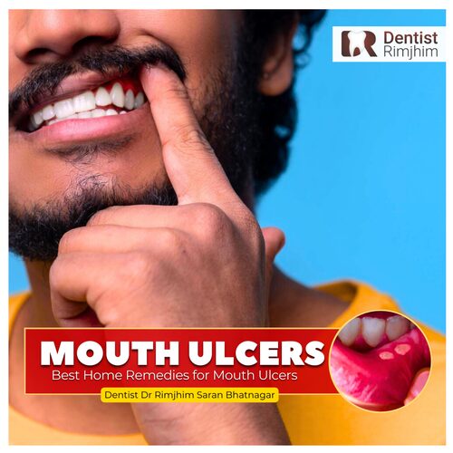 Dr Rimjhim Bhatnagar_best dental surgeon in delhi