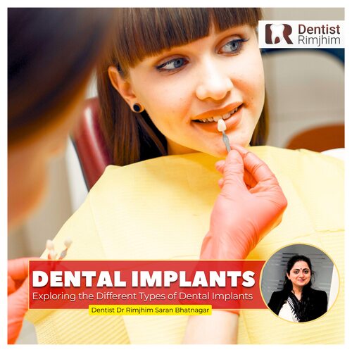 Exploring the Different Types of Dental Implants