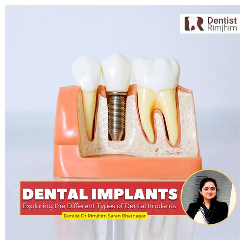 Dr Rimjhim Bhatnagar_best dentist for dental implants in south delhi