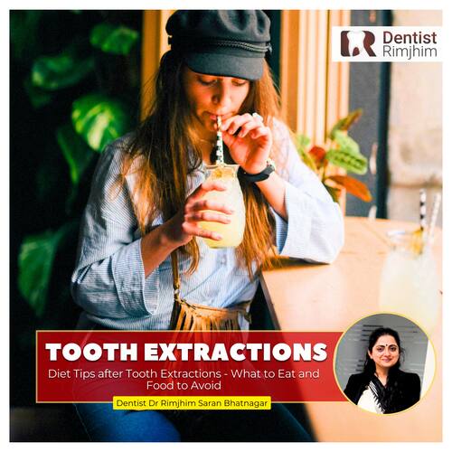 Diet Tips After Tooth Extractions: What to Eat and Foods to Avoid