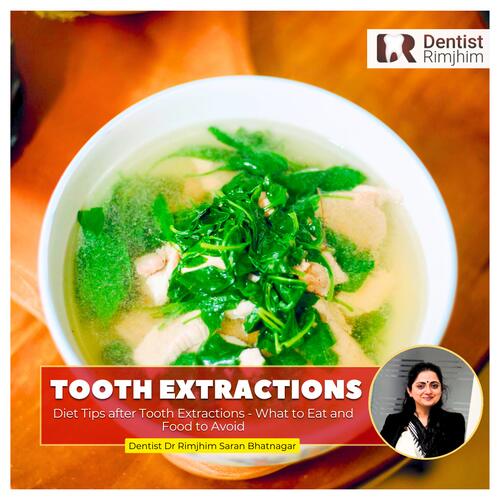 Dr Rimjhim Bhatnagar_delhi's top dental surgeon for tooth extraction