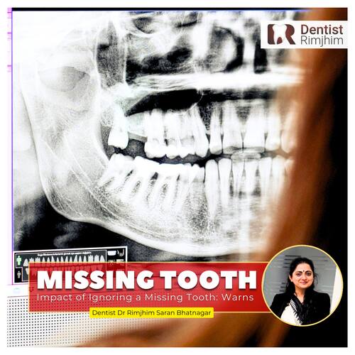 best dental surgeon in delhi ncr_dr rimjhim saran bhatnagar