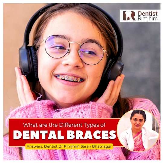 Dr Rimjhim Bhatnagar_best dental braces treatment in delhi ncr