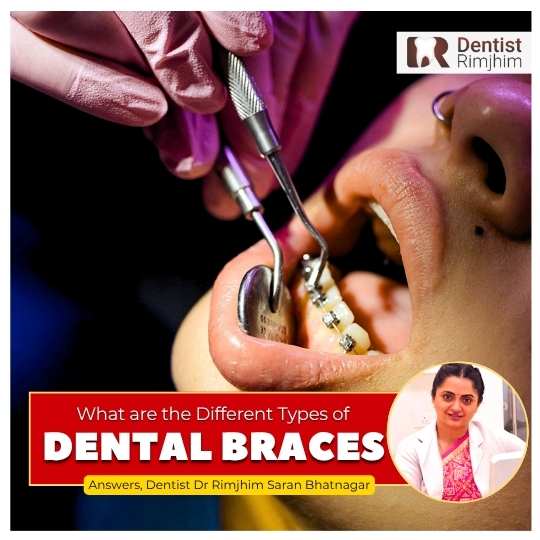 Dr Rimjhim Bhatnagar_best dental braces treatment in delhi