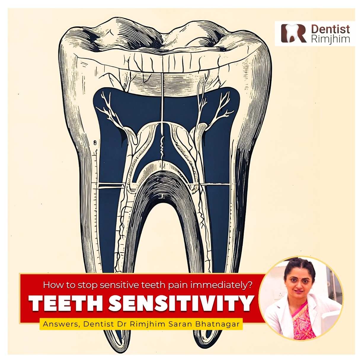 How to Stop Sensitive Teeth Pain Immediately?