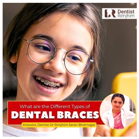 Dr Rimjhim Bhatnagar_best dentist in delhi for braces