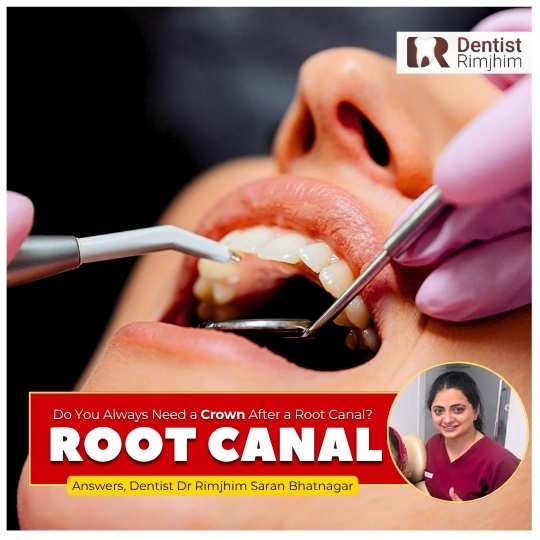 Dr Rimjhim Bhatnagar_best root canal surgery in delhi