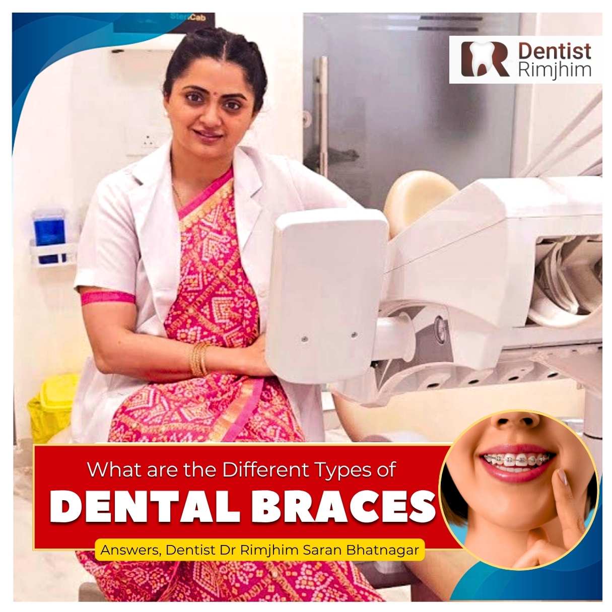 What are the Different Types of Dental Braces?