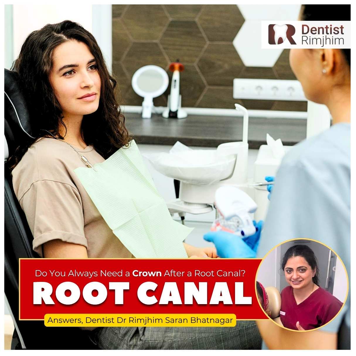 Do You Always Need a Crown After a Root Canal?