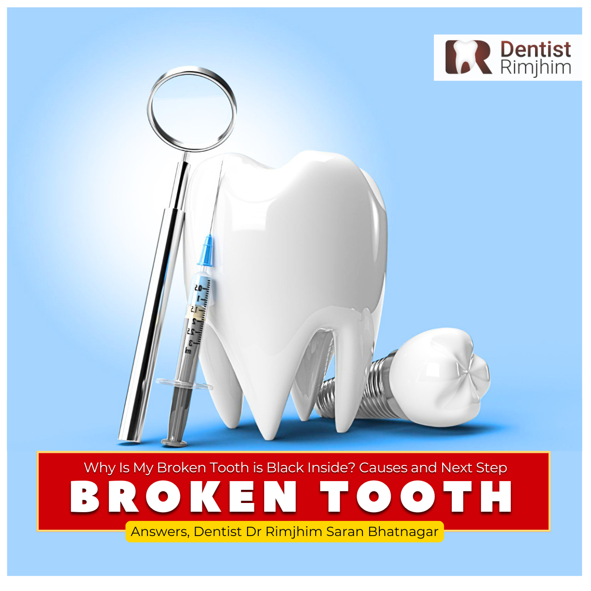 Why Is My Broken Tooth is Black Inside? Causes and Next Steps