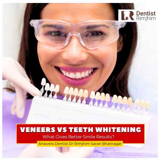 best cosmetic dentist for veneers in gurgaon_dr rimjhim bhatnagar