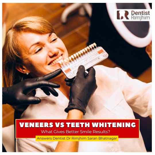 best cosmetic dentist for veneers in south delhi_dr rimjhim bhatnagar