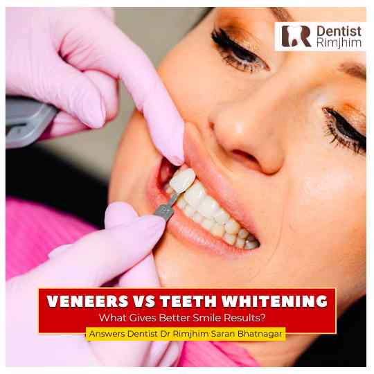 best cosmetic dentist in delhi for veneers_dr rimjhim bhatnagar