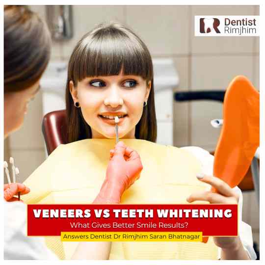 best dentist for veneers in delhi_dr rimjhim bhatnagar