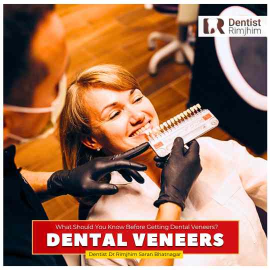 best dental surgeon for dental veneers in delhi ncr_dr rimjhim bhatnagar