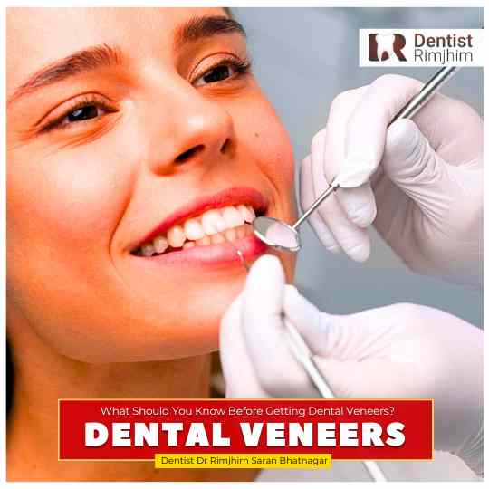 best dentist for dental veneers in delhi ncr_dr rimjhim bhatnagar