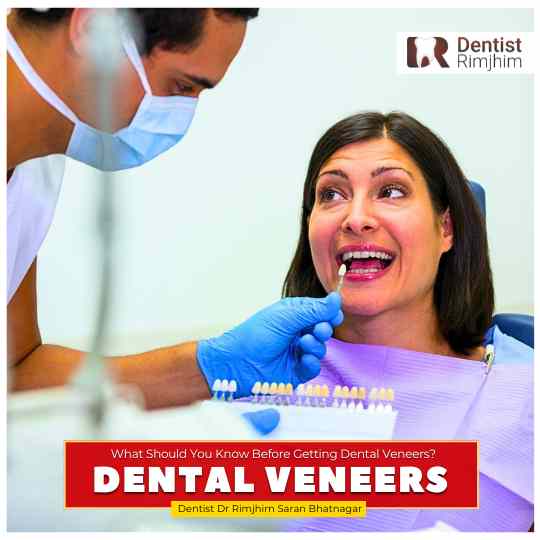 best dentist for dental veneers in south delhi_dr rimjhim bhatnagar