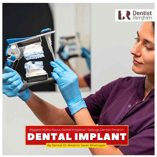 best dentist for implants in delhi_dr rimjhim bhatnagar
