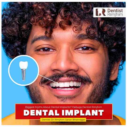 dr rimjhim saran bhatnagar_best dental surgeon in delhi for implants