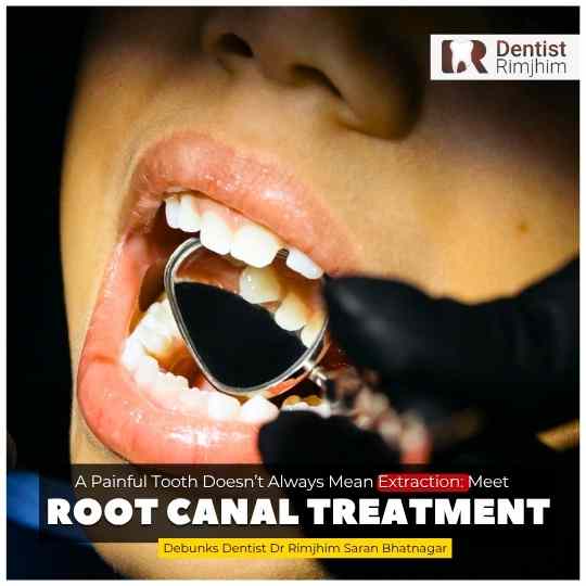 A Painful Tooth Doesn’t Always Mean Extraction: Meet the Root Canal Treatment