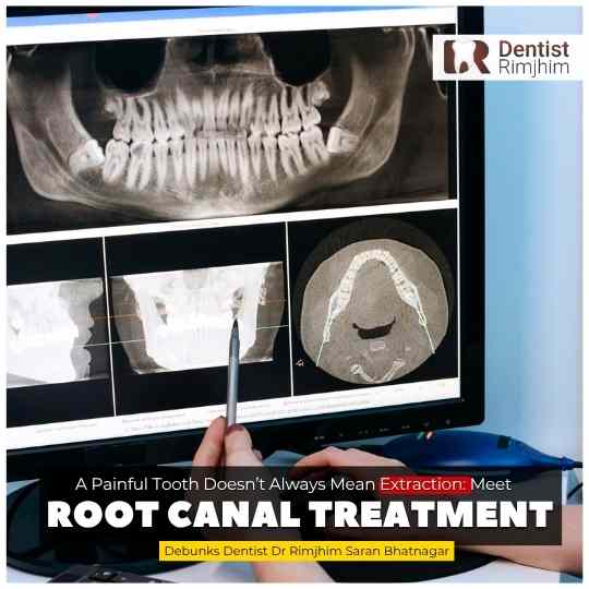 A Painful Tooth Doesn’t Always Mean Extraction: Meet the Root Canal Treatment