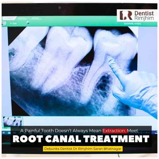 A Painful Tooth Doesn’t Always Mean Extraction: Meet the Root Canal Treatment
