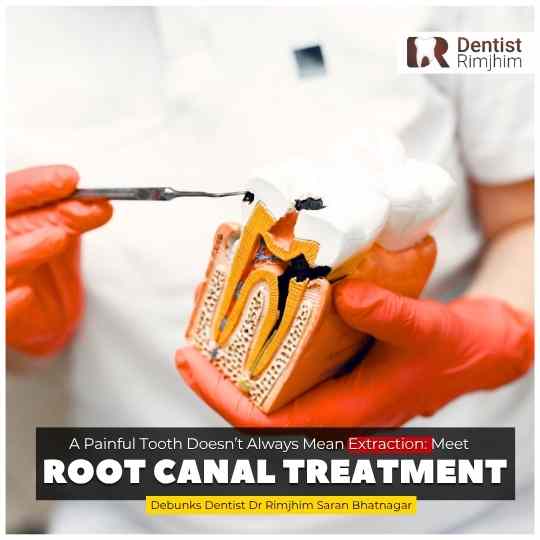 A Painful Tooth Doesn’t Always Mean Extraction: Meet the Root Canal Treatment