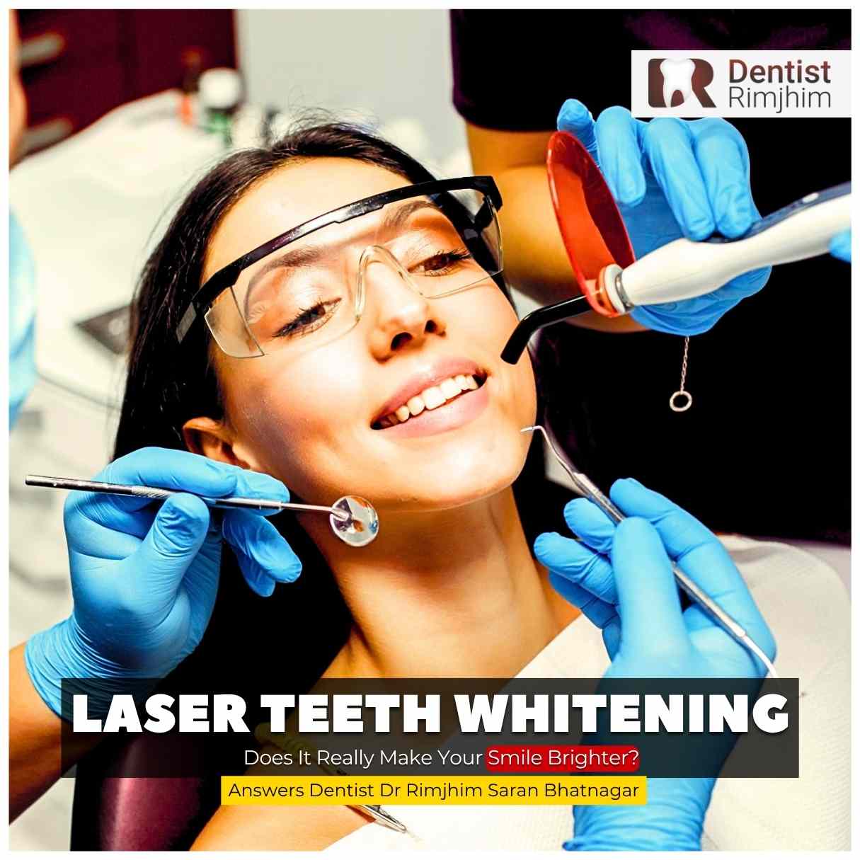 Laser Teeth Whitening: Does It Really Make Your Smile Brighter?