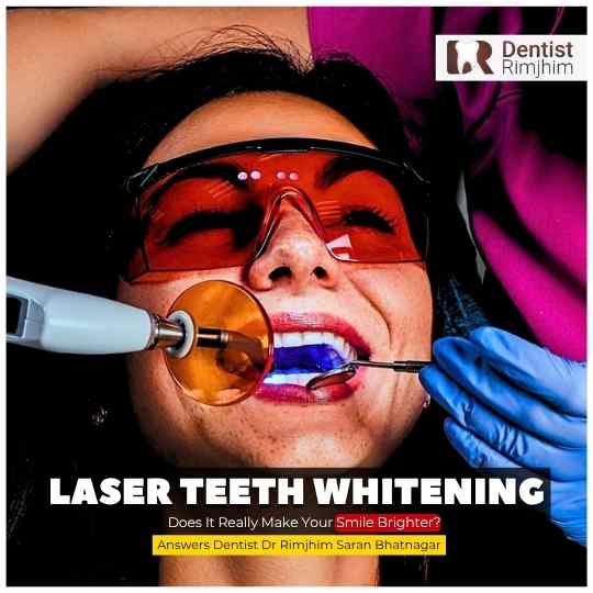 Laser Teeth Whitening: Does It Really Make Your Smile Brighter?