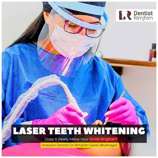 Laser Teeth Whitening: Does It Really Make Your Smile Brighter?